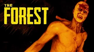 The Forest - Самые Смешные Моменты #76