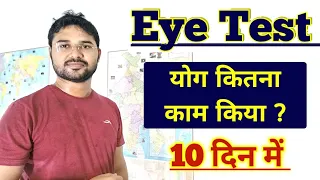 Eye Test for NTPC | दस दिन में कितना ठीक हुआ ? | लगता है ठीक हो जाएगा 😊 #EYE #NTPC