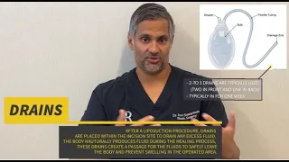 Dr. Ravi's Top Reasons for Using Drains After a Liposuction Procedure