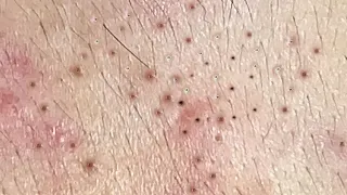 Satisfying Hien Spa Beauty Relaxing Video #10