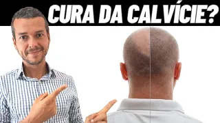 ALIMENTAÇÃO PARA PREVENIR QUEDA DE CABELO E RESISTENCIA INSULINICA E CALVICIE