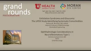 Exfoliation Syndrome & Glaucoma; Ophthalmologic Considerations in Neurofibromatosis Type 1: A Review