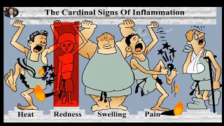 Cardinal signs of inflammation: Prostaglandins and Leukotrienes