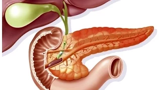 Acute Pancreatitis