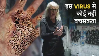Trypophobia Movie Explained In Hindi | Trypophobia Film Explained In Hindi | 100% Horror