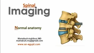 Spinal imaging, normal radiological anatomy (DRE) Prof. Mamdouh Mahfouz