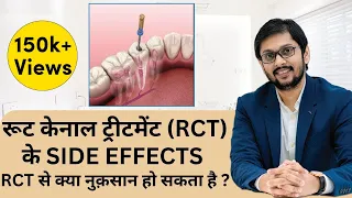 Root canal treatment के फायदे एवं नुकसान क्या होतें हैं ? Side Effect of root canal treatment