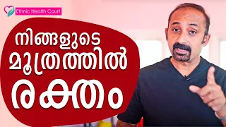 നിങ്ങളുടെ മൂത്രത്തിൽ രക്തം കാണപ്പെട്ടാൽ | Blood in your urine | Ethnic Health Court