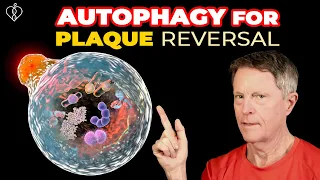 Reversing Arterial Plaque With Autophagy (part 1)