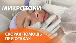 ОТЁКИ НА ЛИЦЕ. Микротоковая терапия как метод скорой помощи