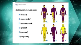 Thermoregulatory Sweat Test (7 of 16)