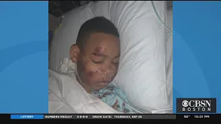 11-Year-Old Boy Recovering From Broken Ribs, Collapsed Lung After Hit-And-Run