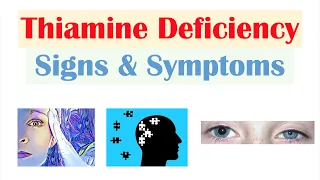 Thiamine (Vit B1) Deficiency Signs & Symptoms (& Why They Occur)