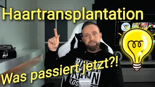 Haartransplantation ! Was passiert jetzt !?