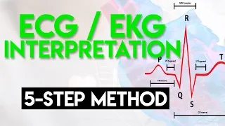 ECG Interpretation Made Easy | ECG EKG Interpretation (Part 2)