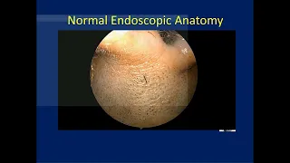 Neurosurgery On the Go: Sinonasal Anatomy – Nasal Cavity and Sphenoid Sinus