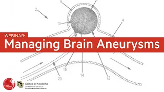 What are the strategies to manage brain aneurysms (old & new) | BAF Webinar with Dr. Seinfeld