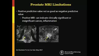 ISMRM MR Academy - Prostate (to guide individual management)