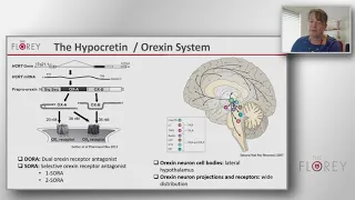 Sleep architecture: Linking neurological & psychiatric disorders with sleep