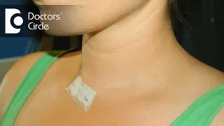 Can thyroid grow back after Total Thyroidectomy? - Dr. Anantharaman Ramakrishnan