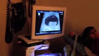 Morgan's baby ultrasound 1/23