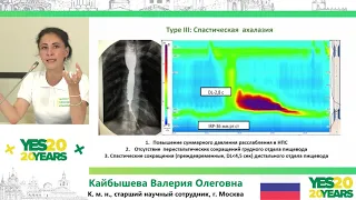 66. Роль манометрии пищевода в выборе тактики лечения пациентов с ГЭРБ. В. О. Кайбышева