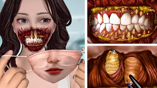 ASMR Remove Parasitic Maggots & Mucus Causing Infection in the mouth | Deep Cleaning Animation