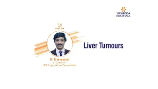 Liver Tumours | Dr. K. Venugopal | Doctor Talk | Yashoda Hospitals, Secunderabad