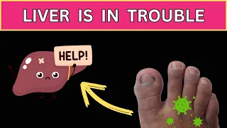 Unlocking The Secrets 6 Shocking Signs Your Feet Reveal About Your Liver's Health