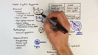 Fetal Cystic Hygroma