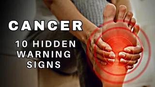 10 Signs You Have Cancer and Don't Know It !!