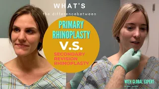 How is a Revision different from a Primary Rhinoplasty  by a Global Expert Dr. Rohrich