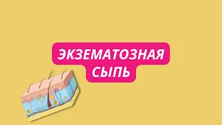 Экзематозная сыпь (экзема, дерматиты) что это, лечение