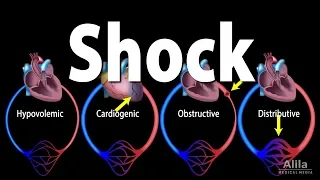 Shock, Pathology of Different Types, Animation