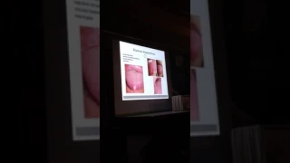 Enfoque práctico de lesiones en mucosa oral. Bogotá 2017