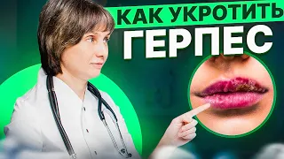 Как укротить герпес Доктор Лисенкова