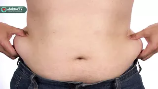 Liposuction sonrası yağlar bir yerde birikir mi? - Doç. Dr. Erdem GÜVEN