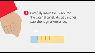 How to Collect a Vaginal Swab Sample | Step-by-Step Guide