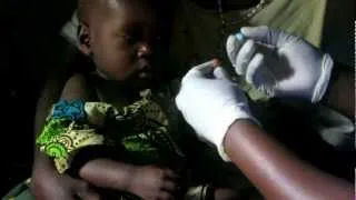 Rapid Diagnostic Test (RDT) for Malaria