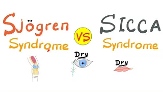 Sjögren Syndrome Vs Sicca Syndrome | Rheumatology