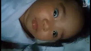 Subtle Seizure in Infants