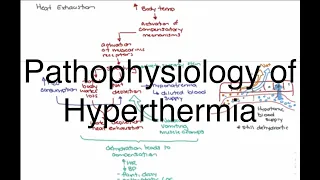 Hyperthermia Pathophysiology