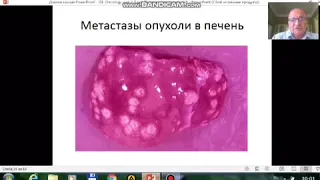 Общее морфология опухолей