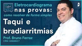 Taqui e bradiarritmias - Eletrocardiograma