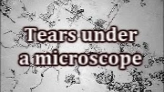 Tears under a microscope