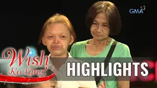 Wish Ko Lang: Ginang na may kakaibang sakit sa balat, tinulungan ng Wish Ko Lang!