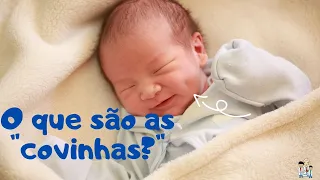 O que são as covinhas?