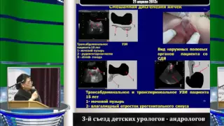 Володько Е А - Исходы лечения врожденных заболеваний органов репродуктивной системы