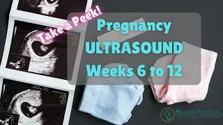 Take a Peek: Weeks 6 to 12 in Pregnancy Scans | Ultrasounds!