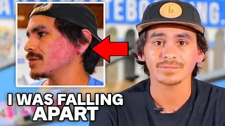 This is why Carlos Lastra Quit Braille Skateboarding